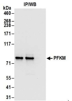 PFKM Antibody