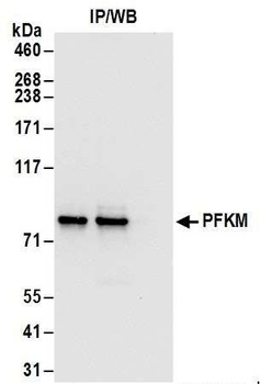 Rabbit anti-PFKM Antibody