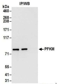 Rabbit anti-PFKM Antibody