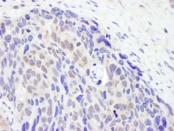 Rabbit anti-TET2 Antibody