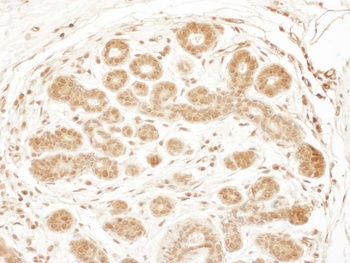 Rabbit anti-RSK3 Antibody