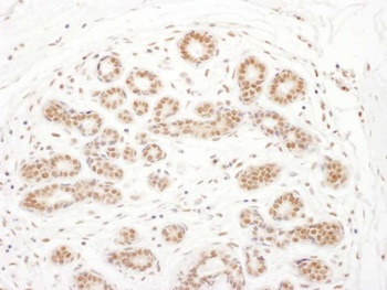 Rabbit anti-RSK3 Antibody