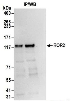 Rabbit ROR2 Antibody