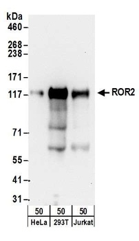 Rabbit ROR2 Antibody