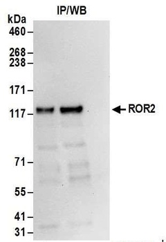 Rabbit ROR2 Antibody