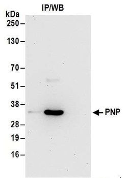 Rabbit PNP Antibody