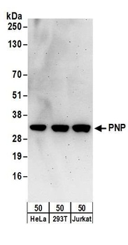 Rabbit PNP Antibody