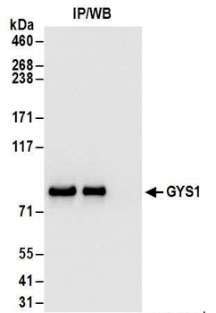 GYS1 Antibody