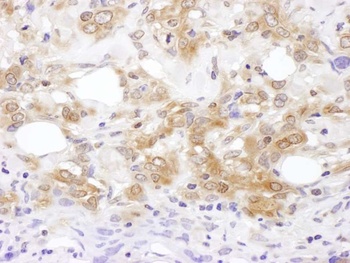 Rabbit anti-MKK7 Antibody