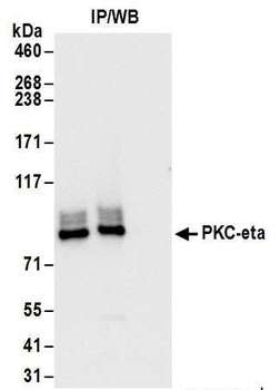 PKC-eta Antibody