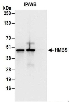 HMBS Antibody