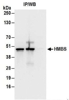 Rabbit anti-HMBS Antibody