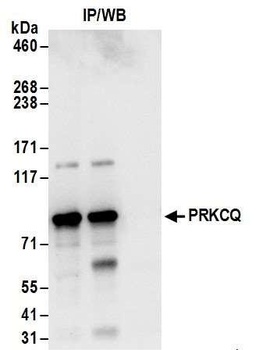 PRKCQ Antibody