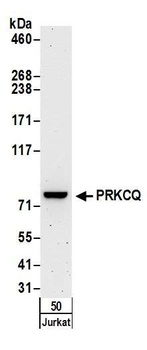 Rabbit PRKCQ Antibody