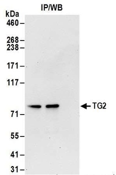 TG2 Antibody