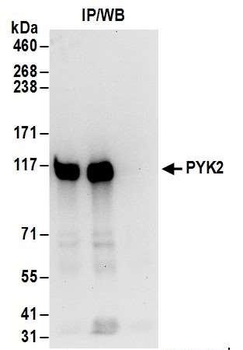 PYK2 Antibody
