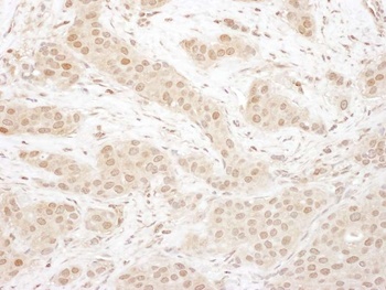 Rabbit anti-CDK4 Antibody