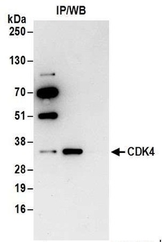 Rabbit anti-CDK4 Antibody