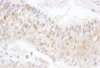 Rabbit anti-CDK4 Antibody