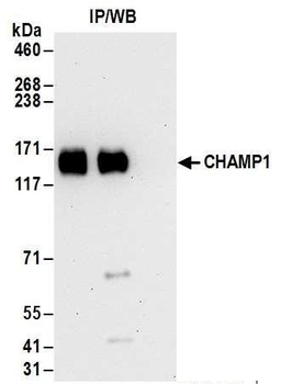 CHAMP1 Antibody