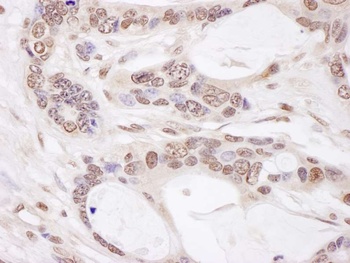 Rabbit anti-CHAMP1 Antibody