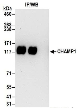 CHAMP1 Antibody