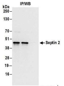 Rabbit Septin 2 Antibody