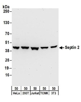 Rabbit Septin 2 Antibody