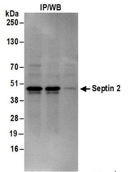 Rabbit Septin 2 Antibody