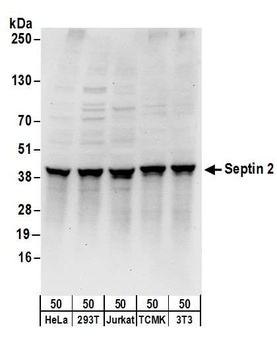 Rabbit Septin 2 Antibody