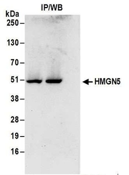 HMGN5 Antibody