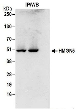 Rabbit anti-HMGN5 Antibody