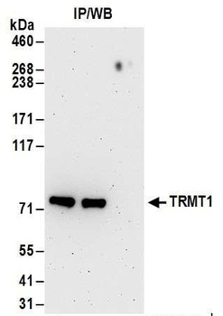 TRMT1 Antibody