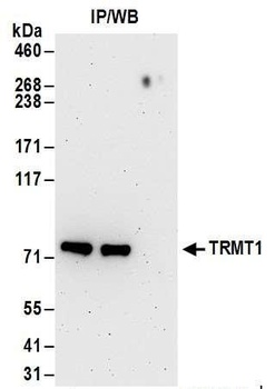 Rabbit anti-TRMT1 Antibody