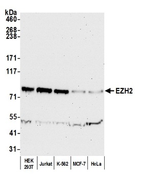Rabbit anti-EZH2 Antibody