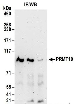 PRMT10 Antibody