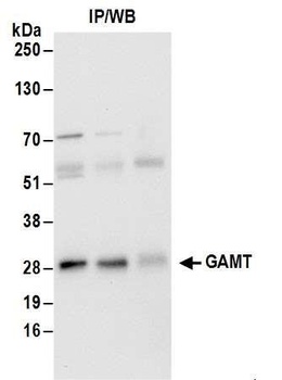 GAMT Antibody