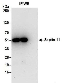 Rabbit Septin 11 Antibody