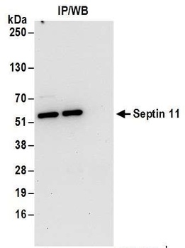 Rabbit Septin 11 Antibody