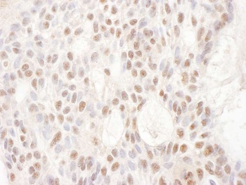 CDKL5 Antibody