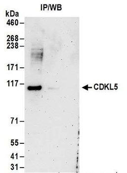 CDKL5 Antibody