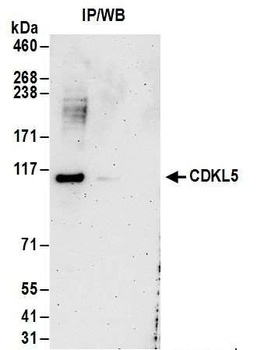 Rabbit anti-CDKL5 Antibody