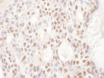 Rabbit anti-CDKL5 Antibody