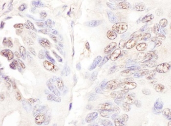Rabbit anti-CDKL5 Antibody