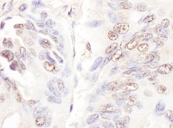 CDKL5 Antibody