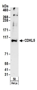 Rabbit anti-CDKL5 Antibody