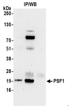 Rabbit PSF1 Antibody