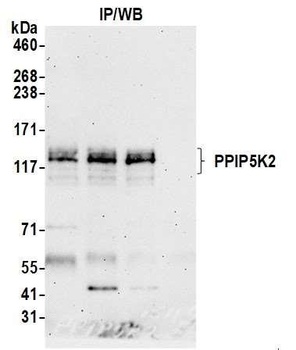 PPIP5K2 Antibody