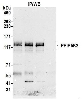 Rabbit anti-PPIP5K2 Antibody