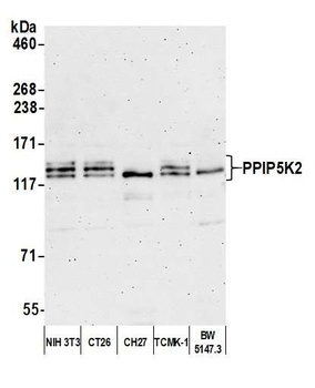 Rabbit anti-PPIP5K2 Antibody
